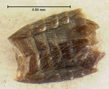 Media type: image;   Entomology 6577 Aspect: abdomen ventral view